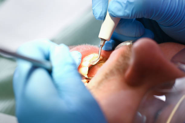 Best Weekend Emergency Dentist in Fletcher, NC