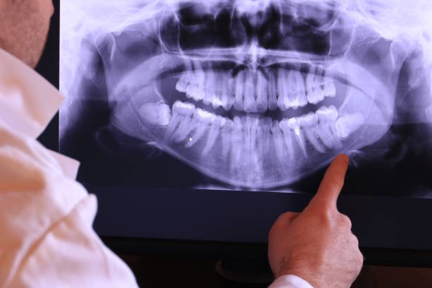 Best Emergency Treatment for Toothache in Fletcher, NC